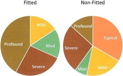 Speech, language, functional communication, psychosocial outcomes and QOL in school-age children with congenital unilateral hearing loss